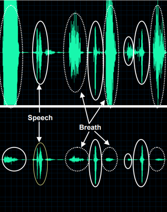 Speech input to Honeywell Voice software without windscreen (top) contrasted with windscreen used (bottom). Note breath noises and plosives (dashed lines) significantly reduced.